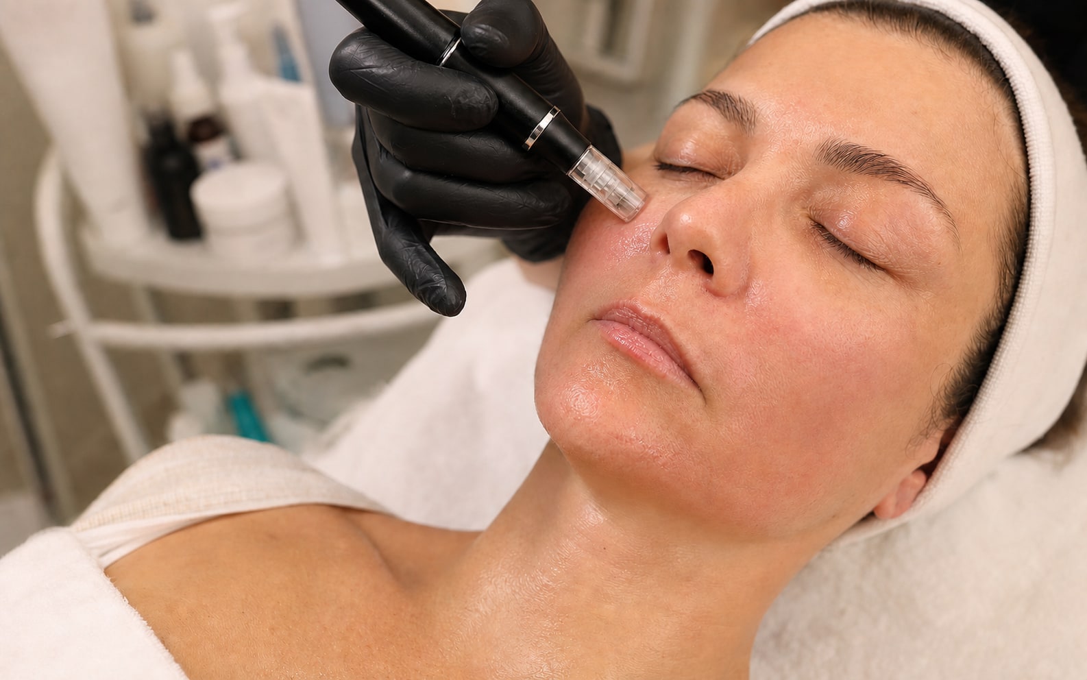 Microneedling-Pen mit Nadelkartusche am Kinn einer Kundin bei Maru Kosmetik in Karlsruhe-Grötzingen